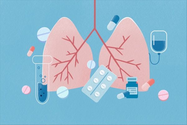 Dupixent® significantly reduced COPD exacerbations in a successful Phase 3 trial, accelerating its FDA submission as a potential first approved biologic for this serious condition