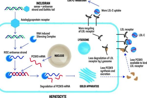 Inclisiran Market Analysis in the USA: Patents, Exclusivity, and Market Entry Outlook