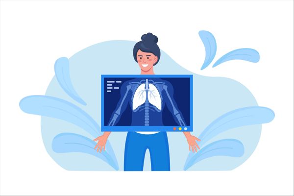 IDeate-Lung01 Phase 2 Trial: Promising Response Rates with Ifinatamab Deruxtecan in Advanced Small Cell Lung Cancer