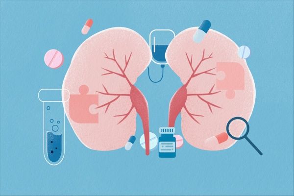 8-Year Study Reveals Superior Survival with Opdivo-Yervoy vs Sunitinib for Untreated Advanced Kidney Cancer