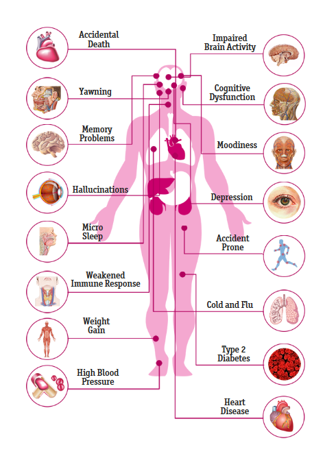 Sleep deprivation infographic