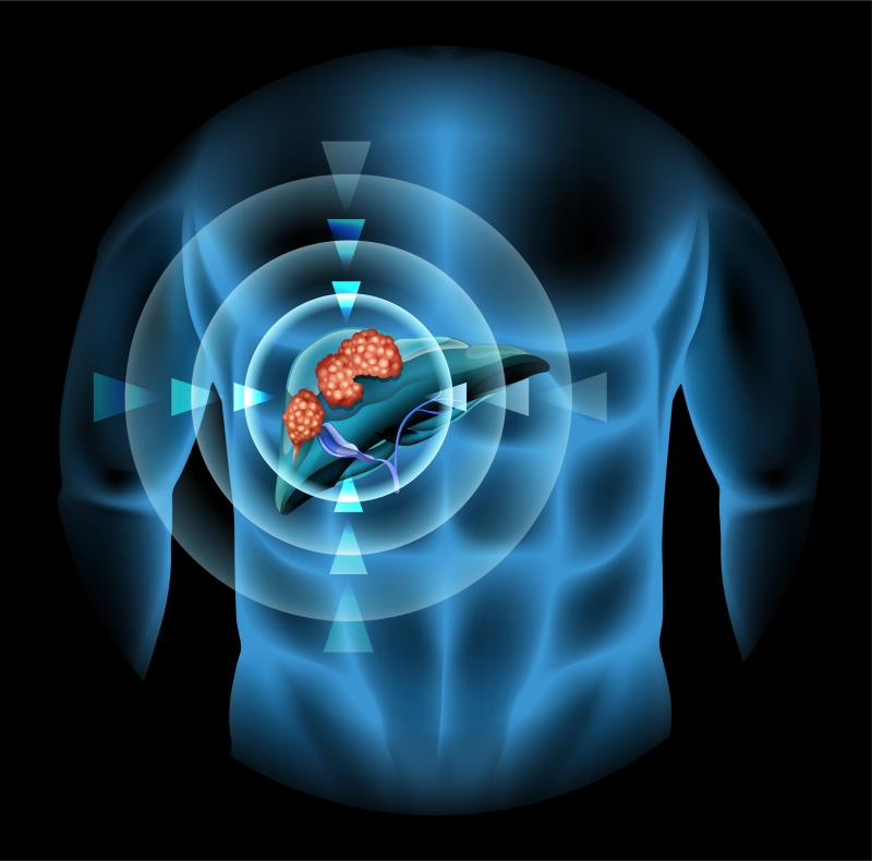 Relationship between tumour response to systemic therapy and overall survival in unresectable hepatocellular carcinoma